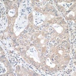 Detection of human MTHFR by immunohistochemistry.