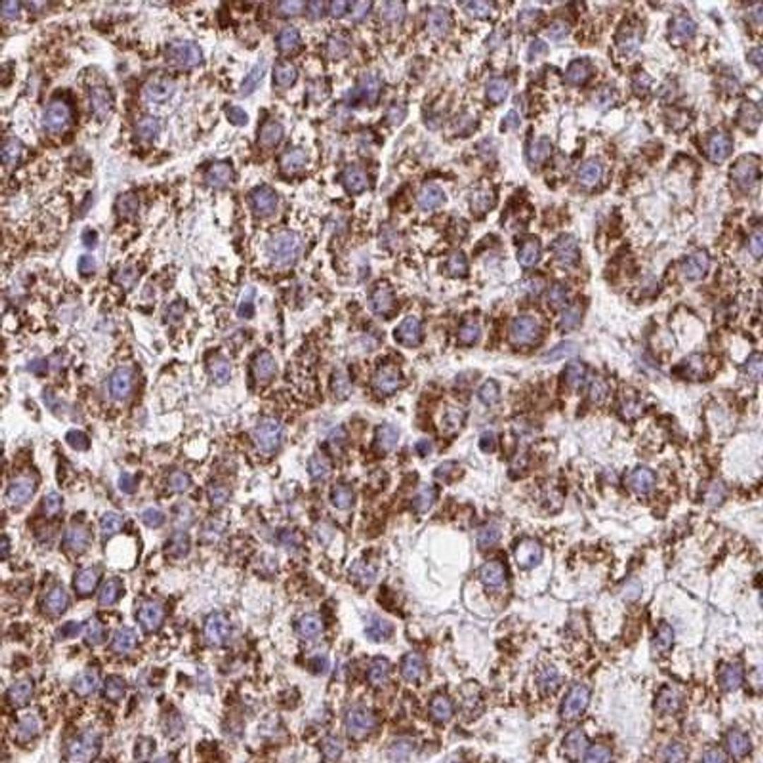 Immunohistochemistry: ATP5O Antibody [NBP2-32602] - Immunohistochemical staining of human kidney shows strong cytoplasmic positivity in cells in tubules.