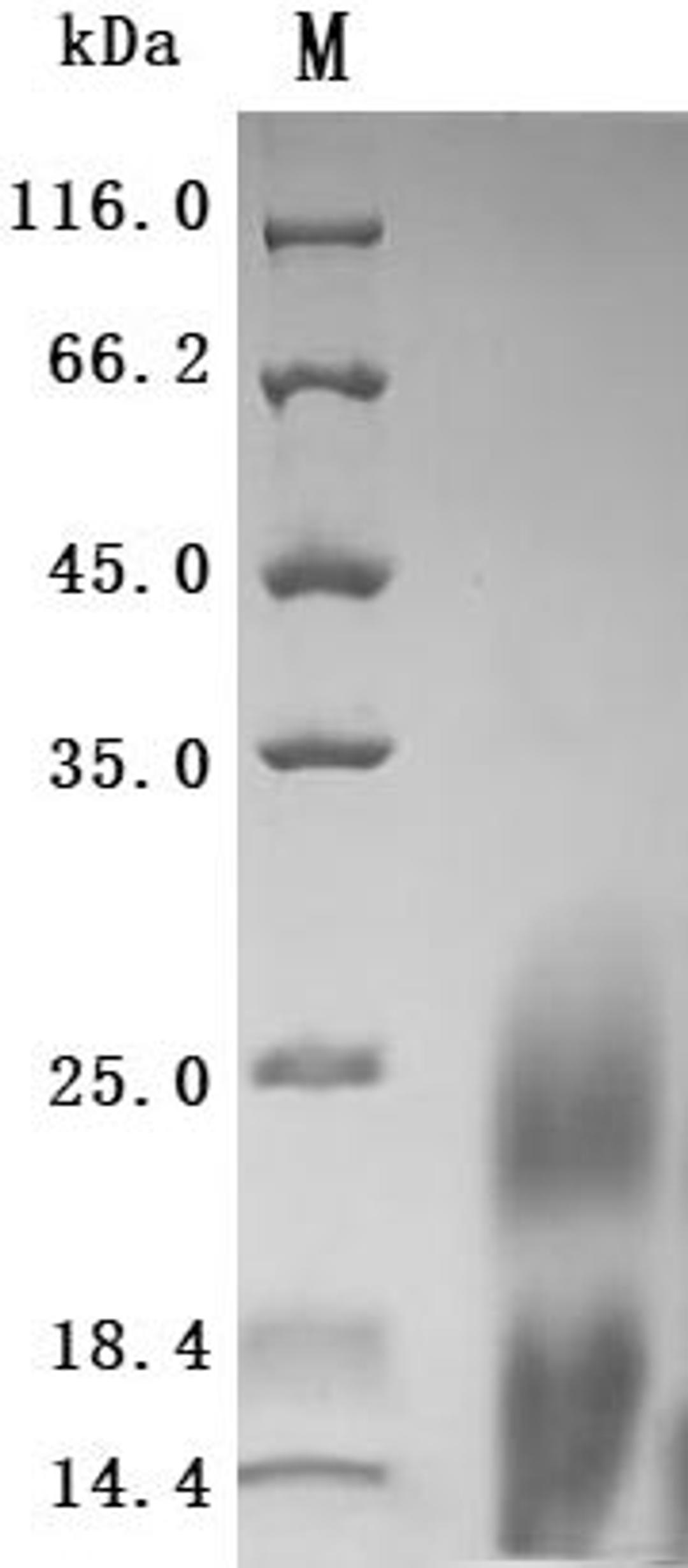 (Tris-Glycine gel) Discontinuous SDS-PAGE (reduced) with 5% enrichment gel and 15% separation gel.