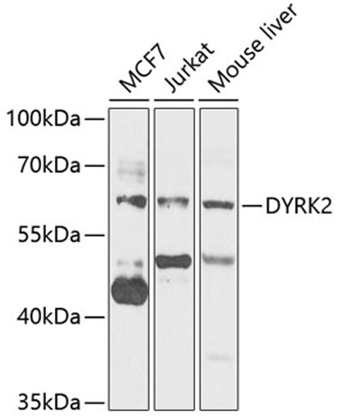 Western blot - DYRK2 antibody (A7012)