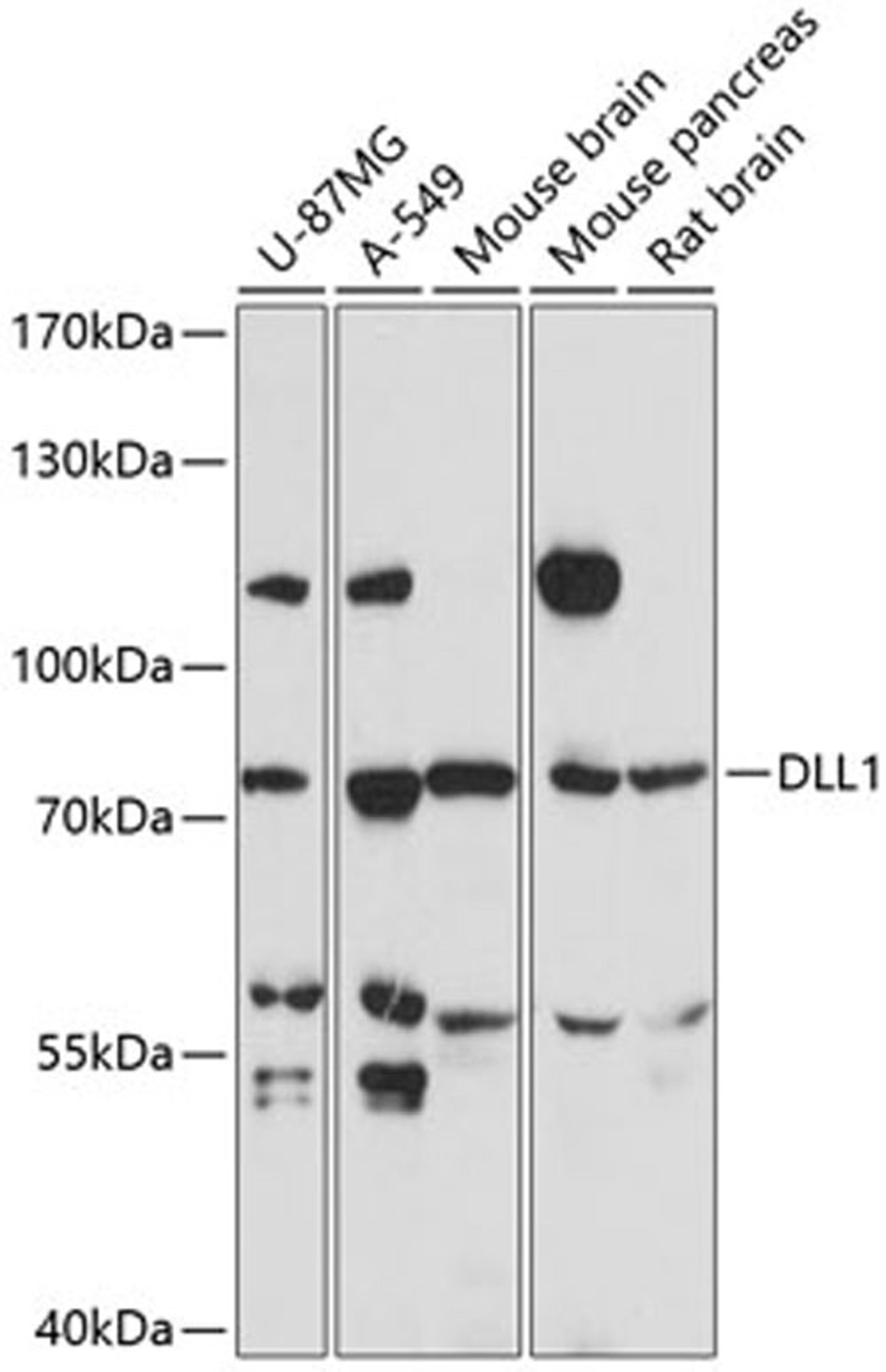 Western blot - DLL1 antibody (A14277)