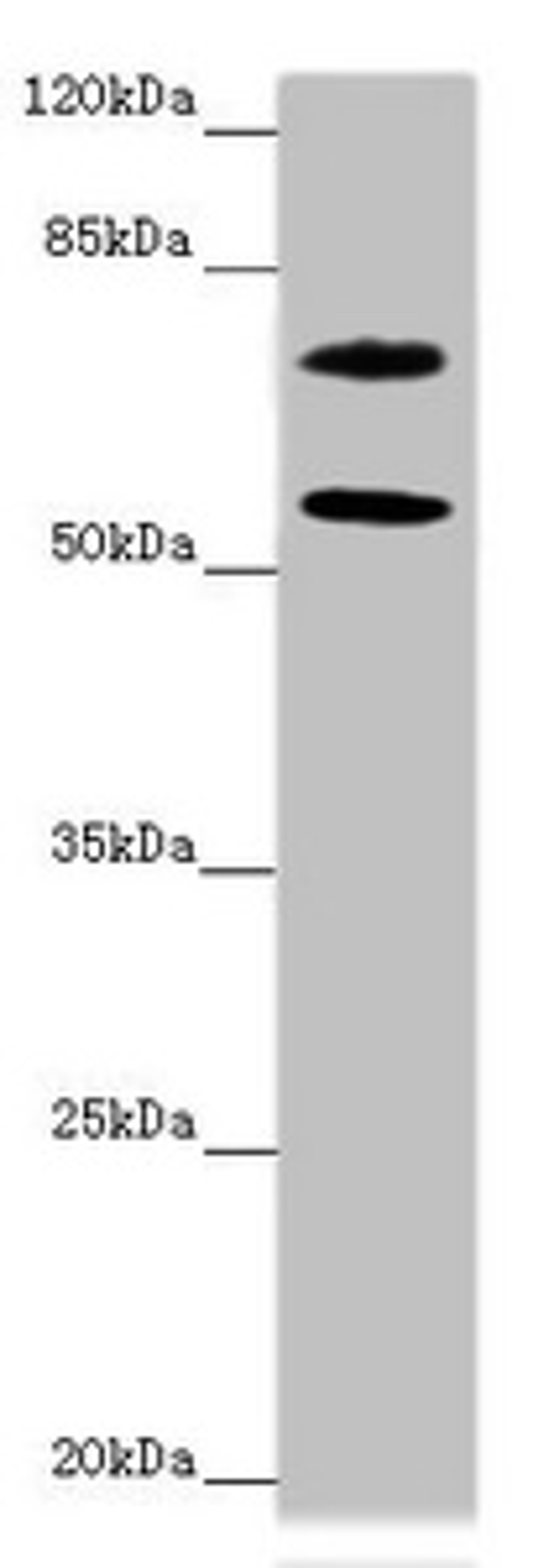 Western blot. All lanes: MOCS1 antibody at 2.24 ug/ml + Jurkat whole cell lysate. Secondary. Goat polyclonal to rabbit IgG at 1/10000 dilution. Predicted band size: 71, 44, 41, 32, 69, 59 kDa. Observed band size: 71, 55 kDa. 