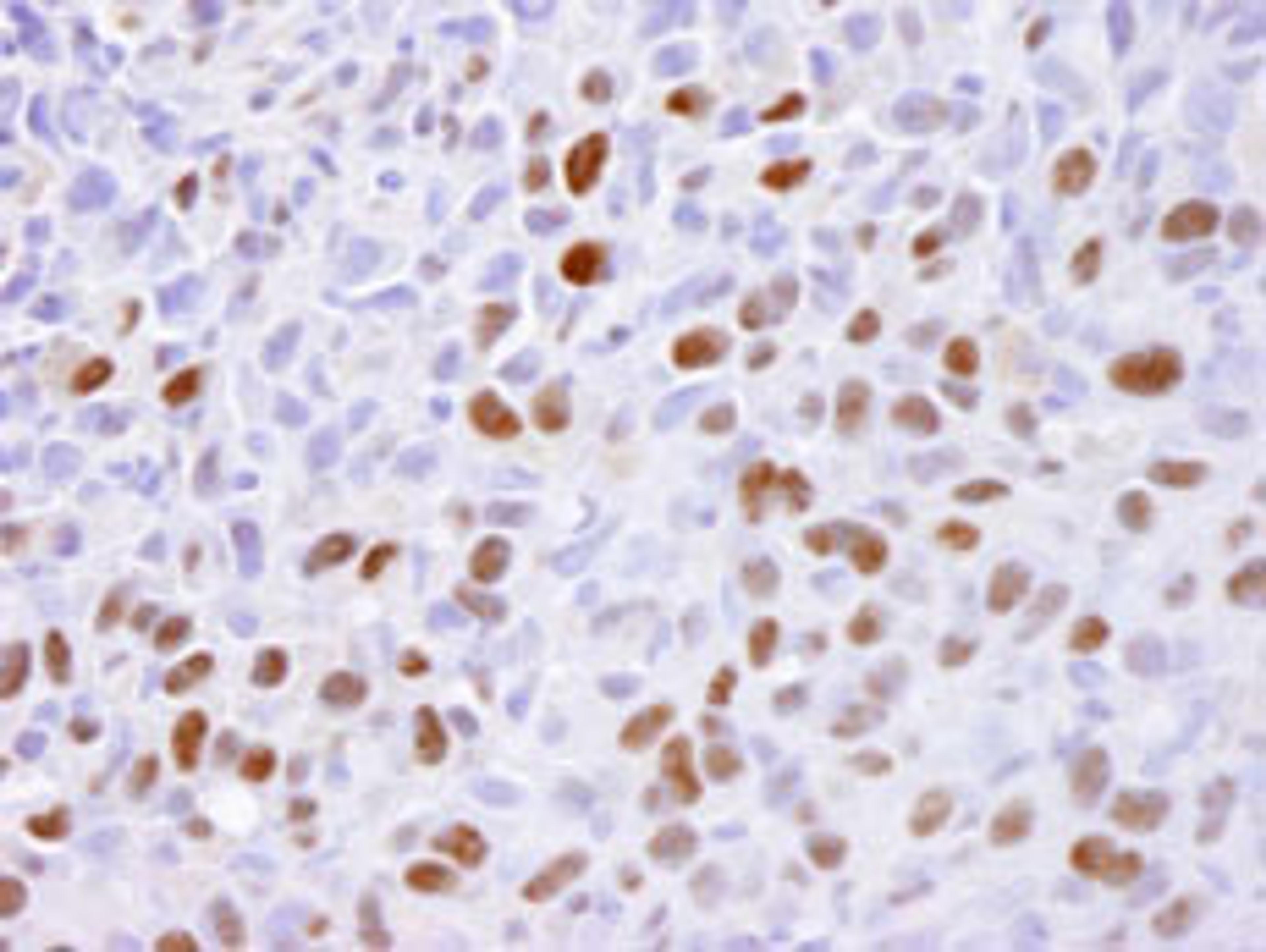 Detection of mouse MCM2 by immunohistochemistry.