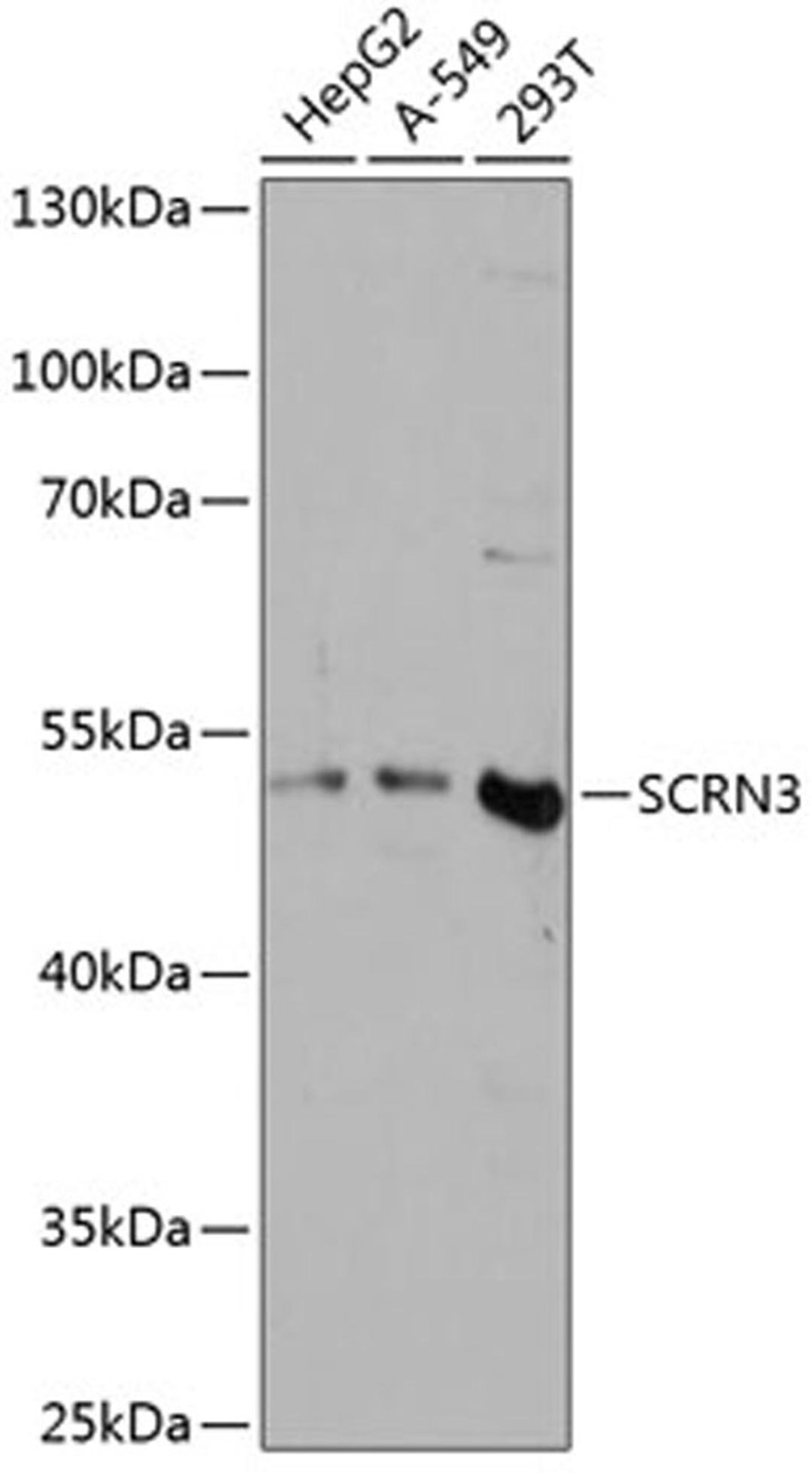 Western blot - SCRN3 antibody (A14421)