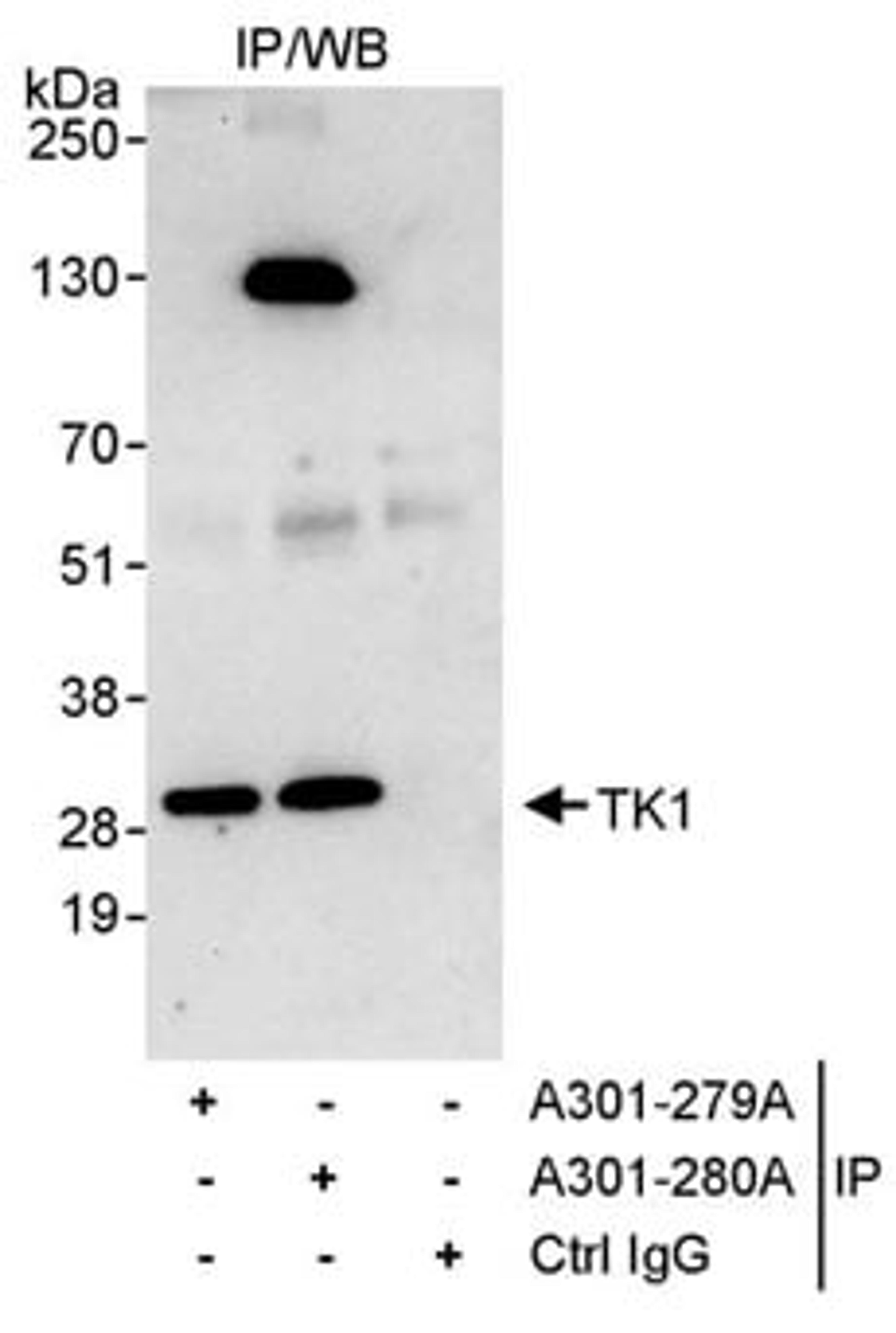 Detection of human TK1 by western blot of immunoprecipitates.