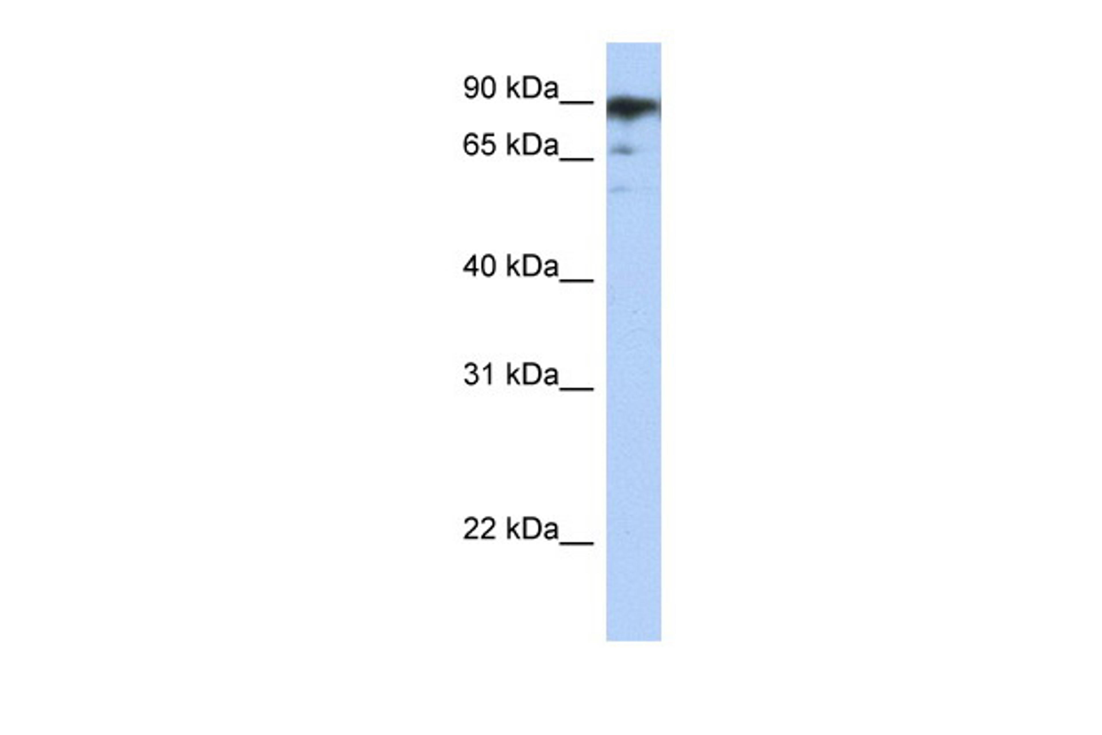 Antibody used in WB on Human NTERA2 at 1.25 ug/ml.