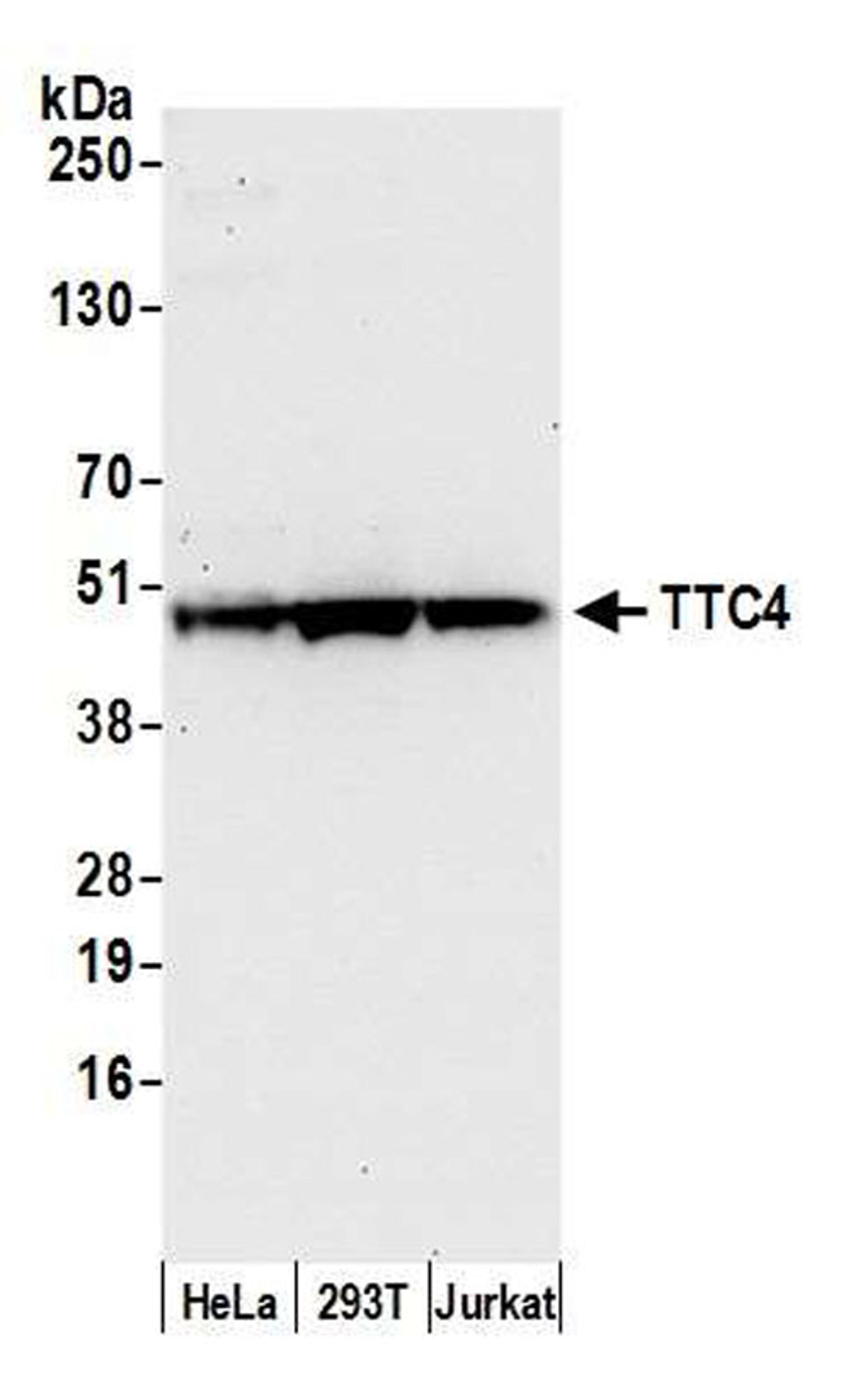 Detection of human TTC4 by WB.