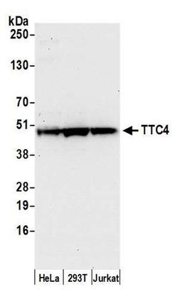Detection of human TTC4 by WB.