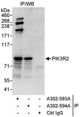 Detection of human PIK3R2 by western blot of immunoprecipitates.