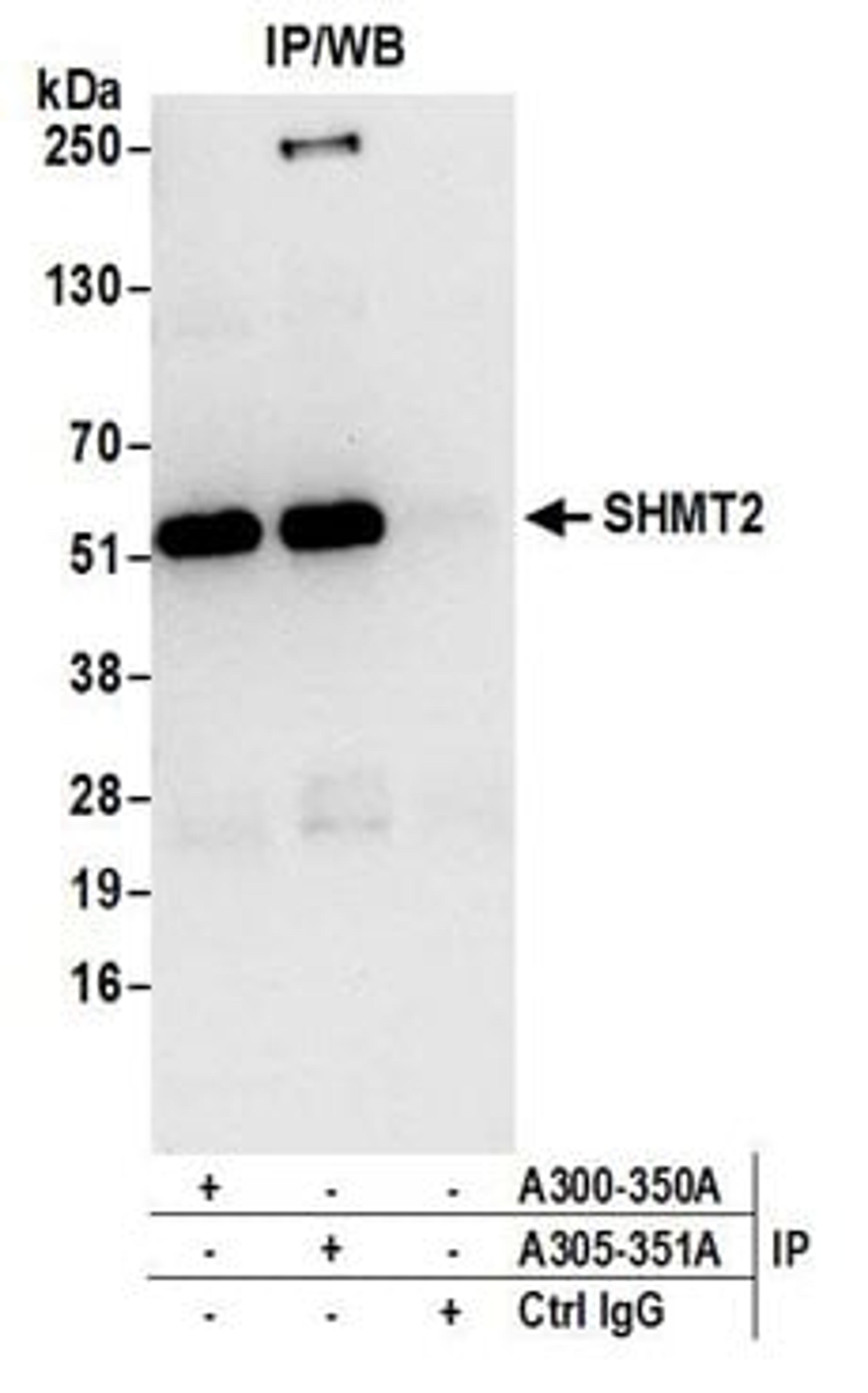 Detection of human SHMT2 by western blot of immunoprecipitates.