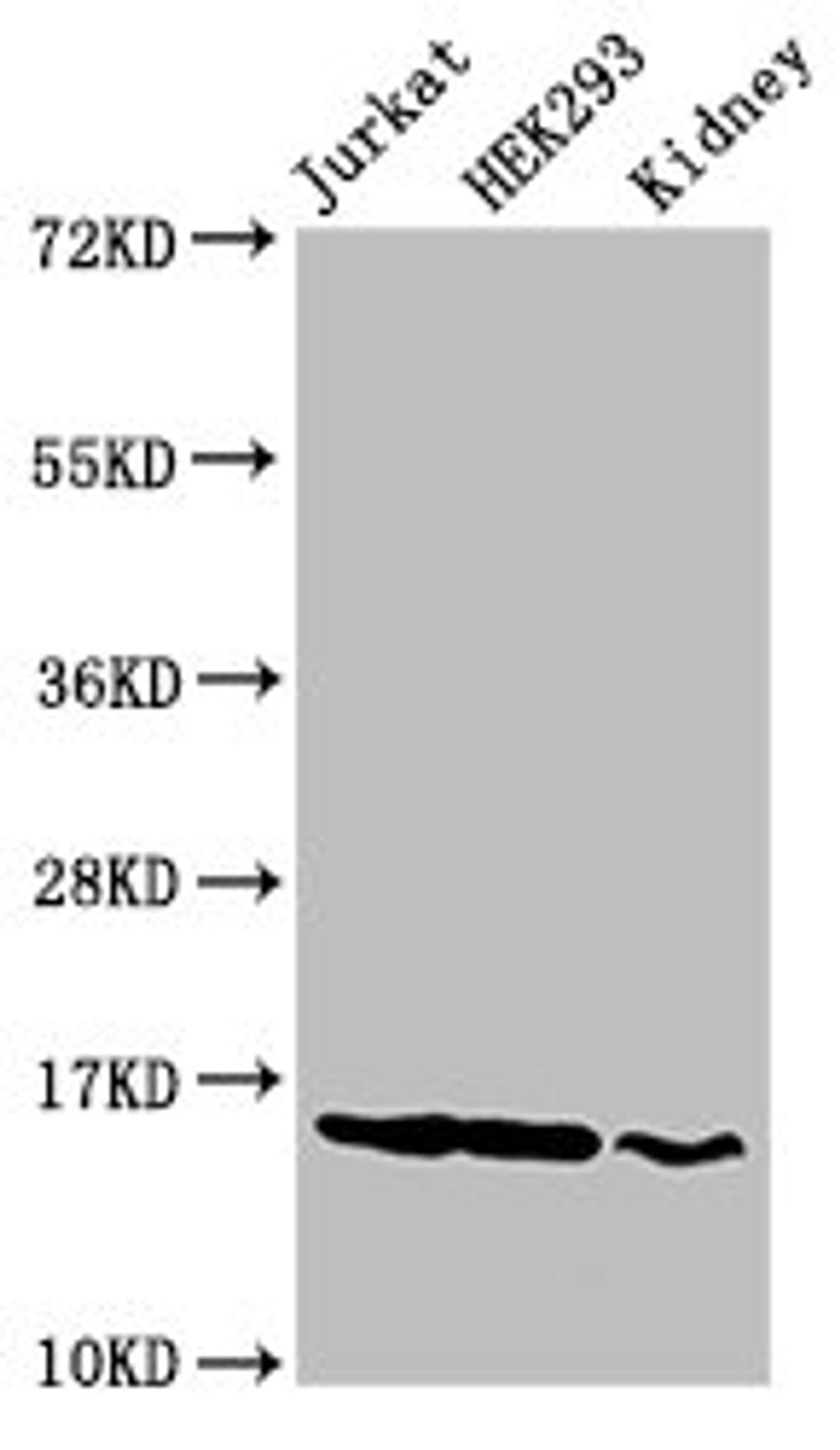 Western Blot. Positive WB detected in: Jurkat cell acid extracts, HEK293 cell acid extracts, Rat kidney tissue. All lanes: HIST1H3A antibody at 2µg/ml. Secondary. Goat polyclonal to rabbit IgG at 1/50000 dilution. Predicted band size: 16 kDa. Observed band size: 16 kDa