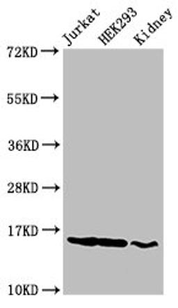 Western Blot. Positive WB detected in: Jurkat cell acid extracts, HEK293 cell acid extracts, Rat kidney tissue. All lanes: HIST1H3A antibody at 2µg/ml. Secondary. Goat polyclonal to rabbit IgG at 1/50000 dilution. Predicted band size: 16 kDa. Observed band size: 16 kDa