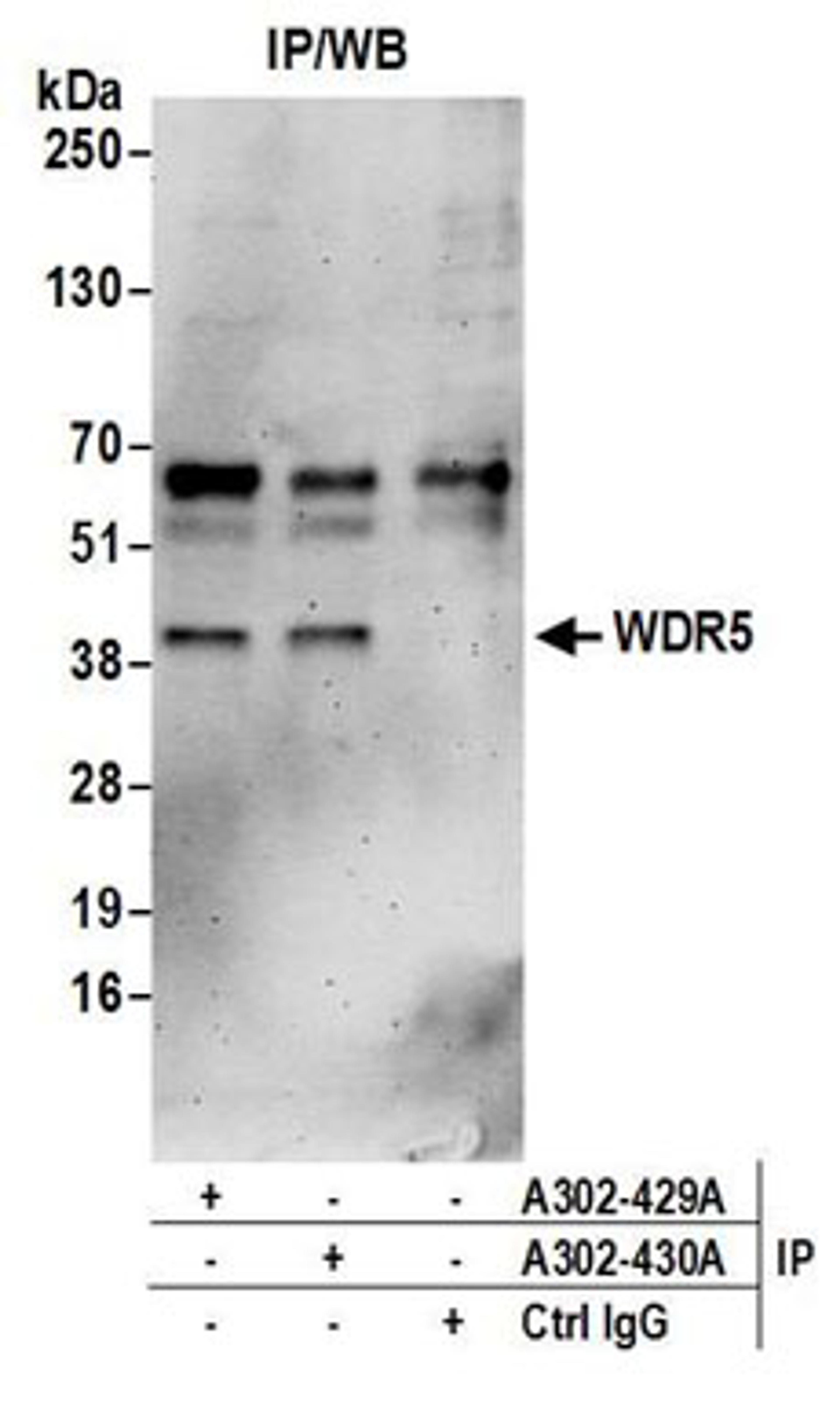 Detection of human WDR5 by western blot of immunoprecipitates.