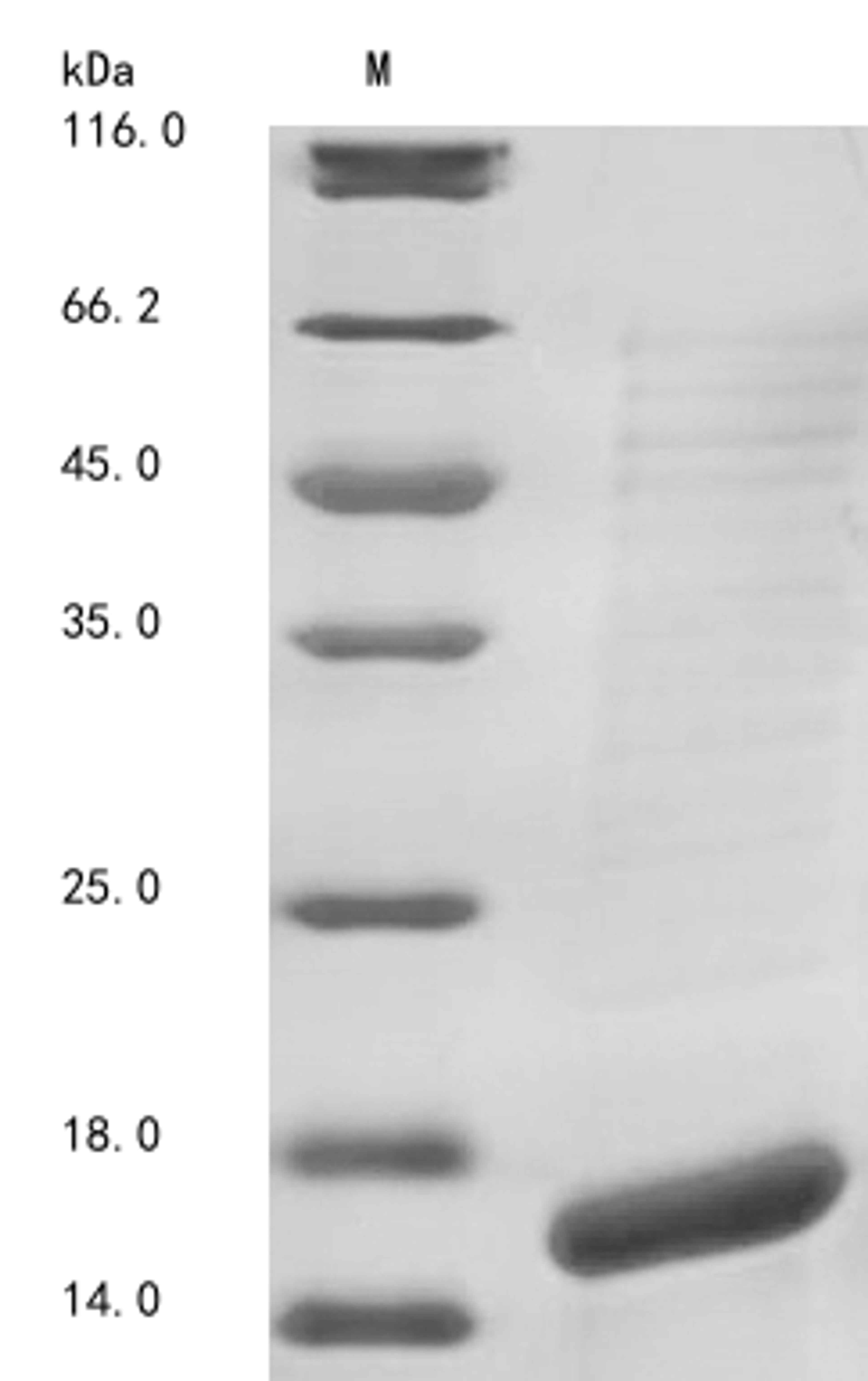 (Tris-Glycine gel) Discontinuous SDS-PAGE (reduced) with 5% enrichment gel and 15% separation gel.