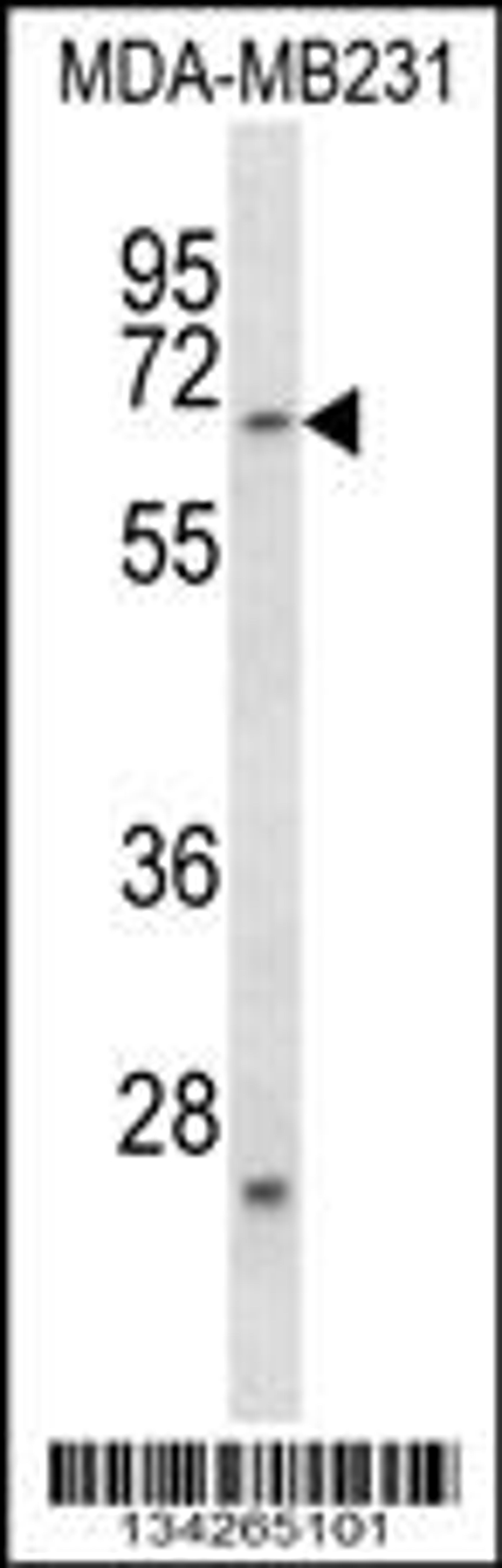 Western blot analysis in MDA-MB231 cell line lysates (35ug/lane).