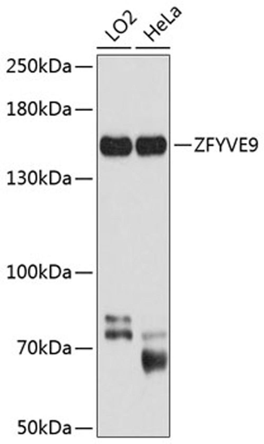 Western blot - ZFYVE9 antibody (A9041)