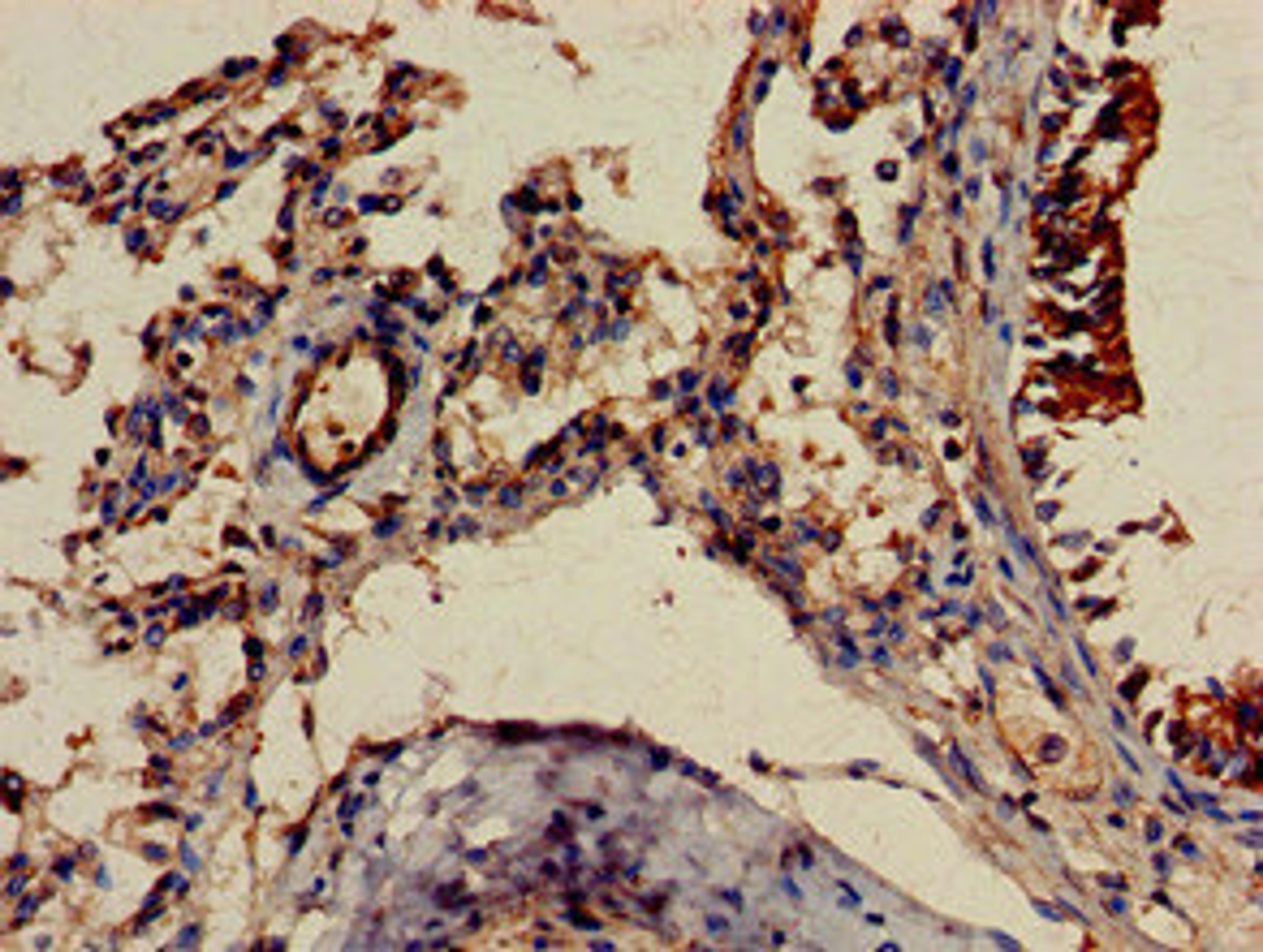 Immunohistochemistry of paraffin-embedded human lung tissue using CSB-PA008655LA01HU at dilution of 1:100