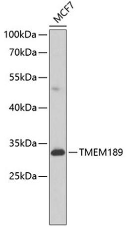 Western blot - TMEM189 antibody (A8380)