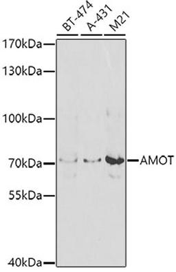 Western blot - AMOT antibody (A8075)