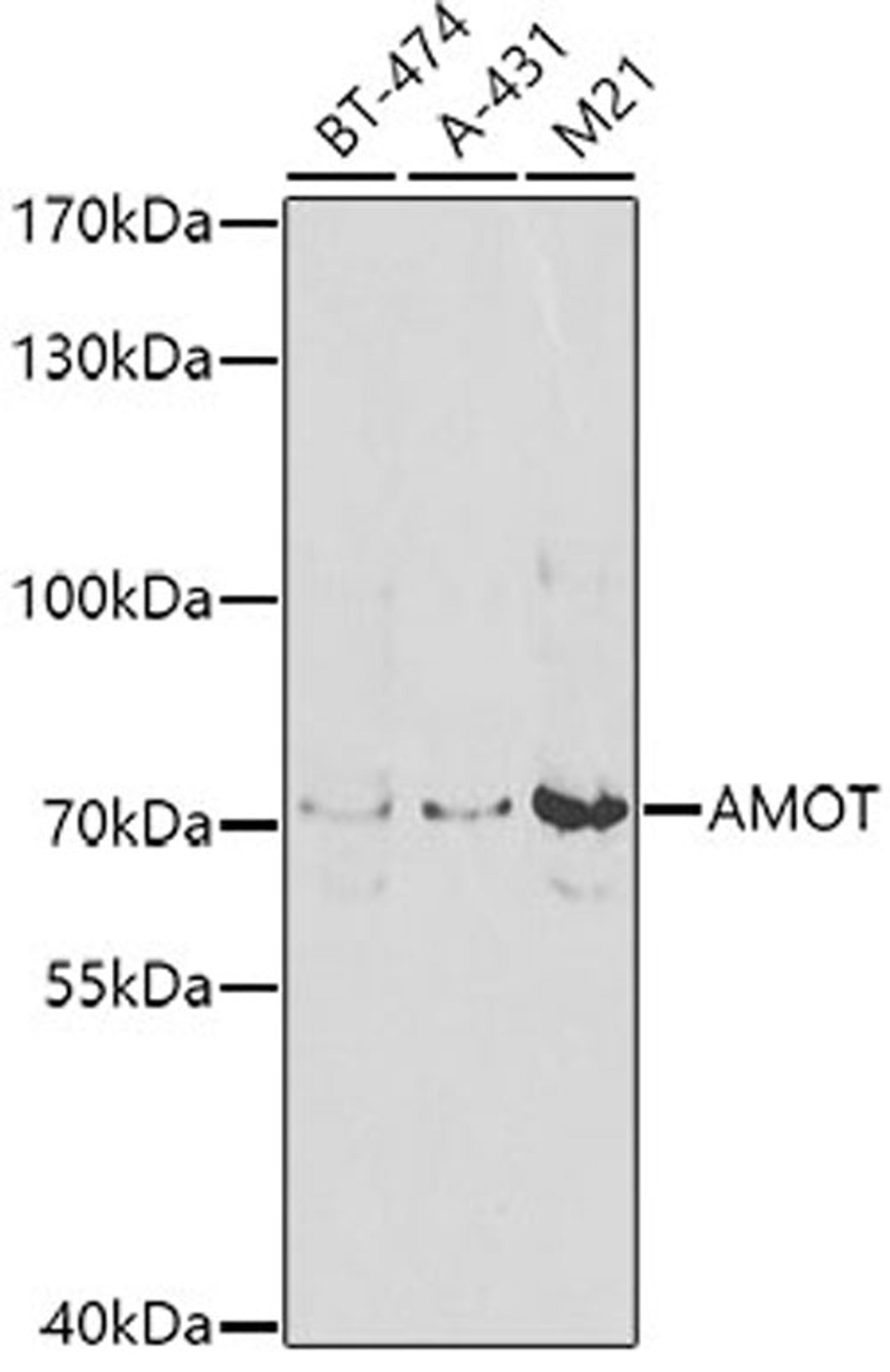 Western blot - AMOT antibody (A8075)