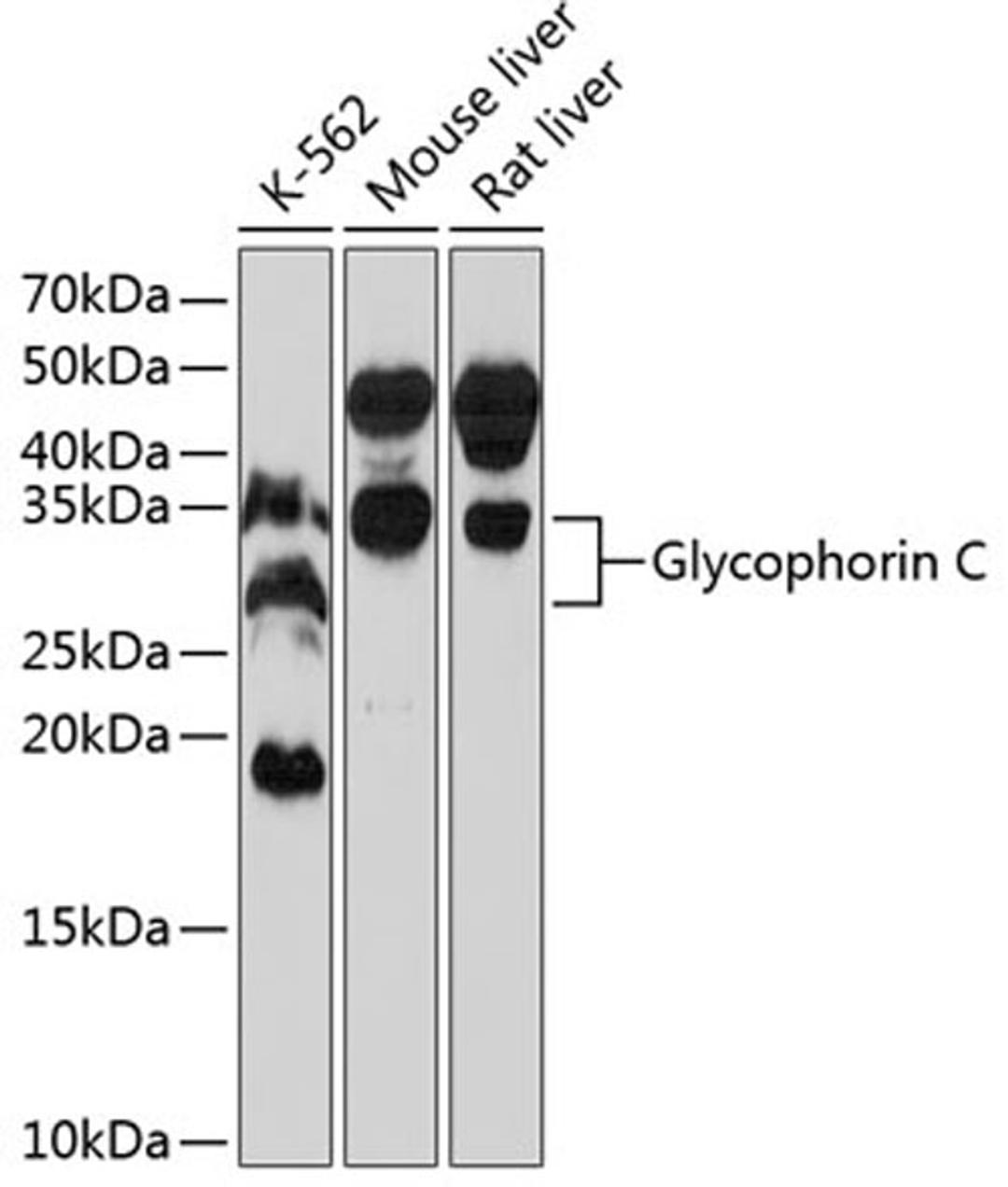 Western blot - Glycophorin C Rabbit mAb (A11472)