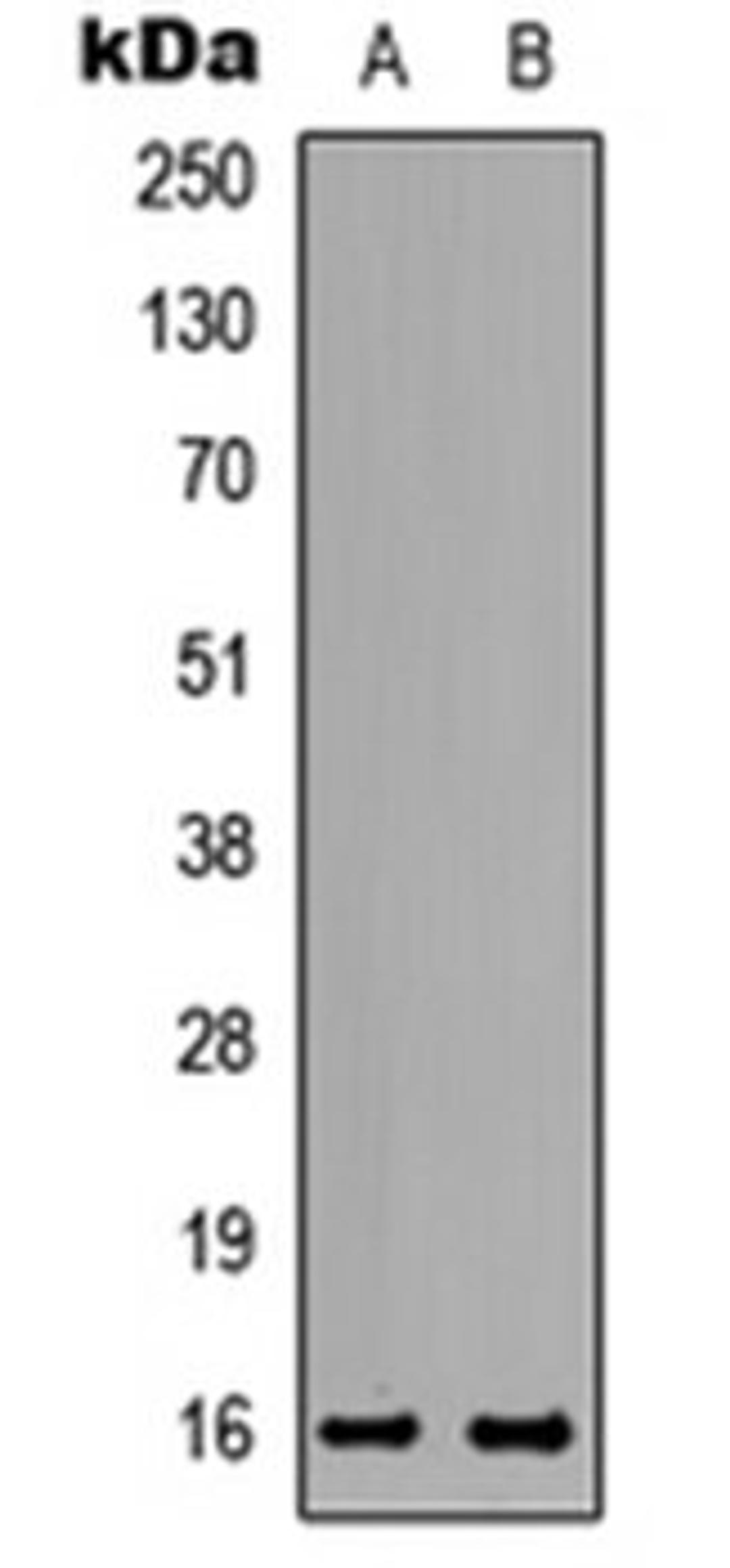 Western blot analysis of HeLa (Lane 1), PC12 (Lane 2) whole cell lysates using TNP2 antibody