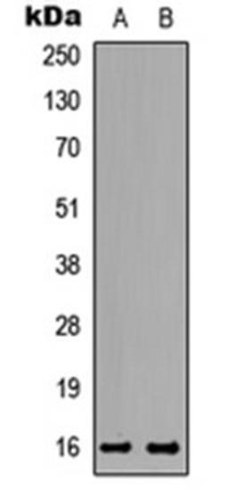 Western blot analysis of HeLa (Lane 1), PC12 (Lane 2) whole cell lysates using TNP2 antibody