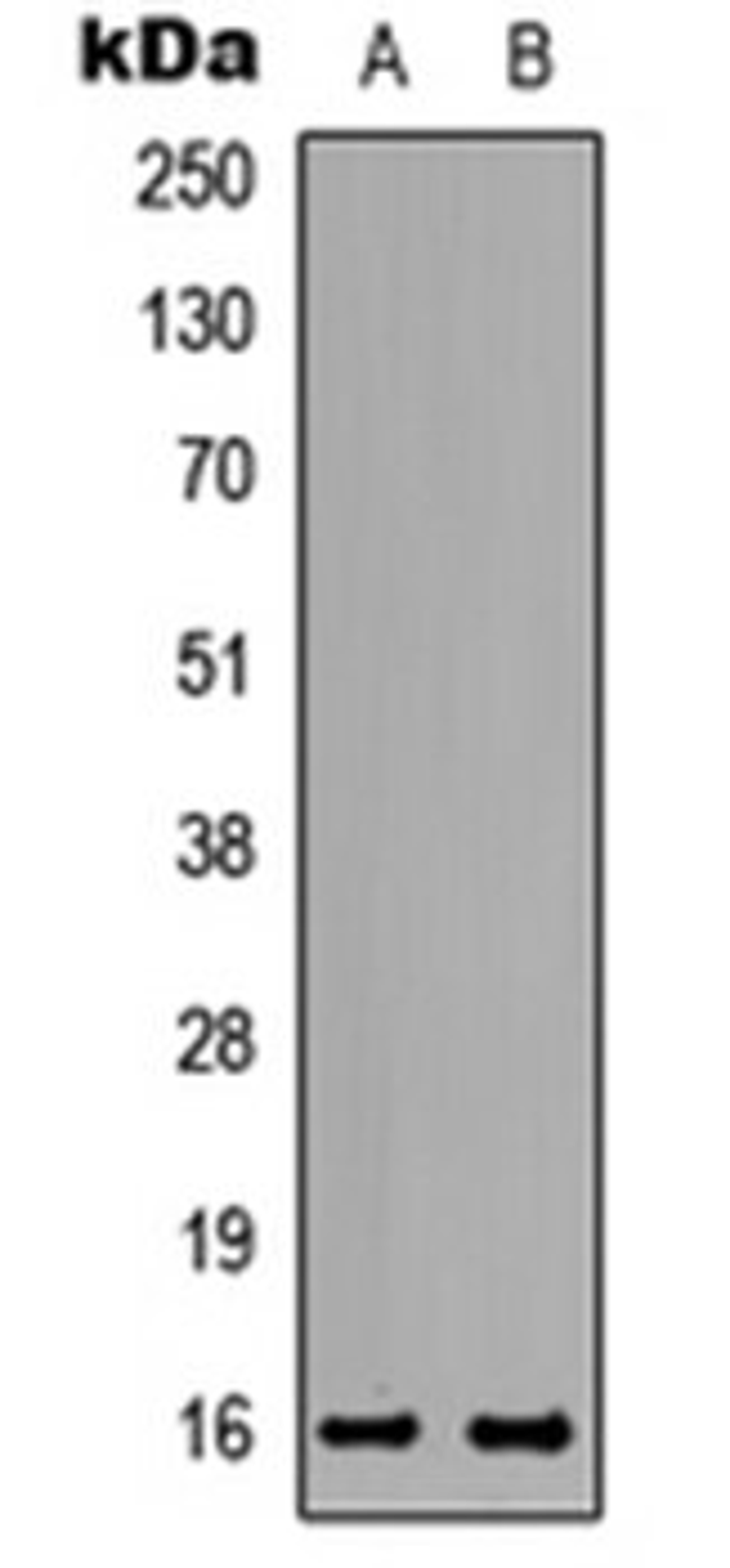 Western blot analysis of HeLa (Lane 1), PC12 (Lane 2) whole cell lysates using TNP2 antibody