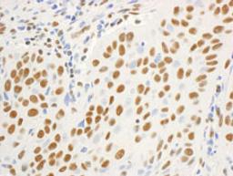 Detection of human DBC1/p30 DBC by immunohistochemistry.