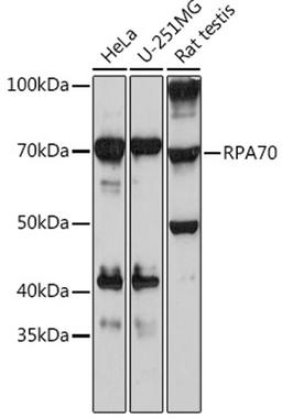 Western blot - RPA70 Rabbit mAb (A3367)