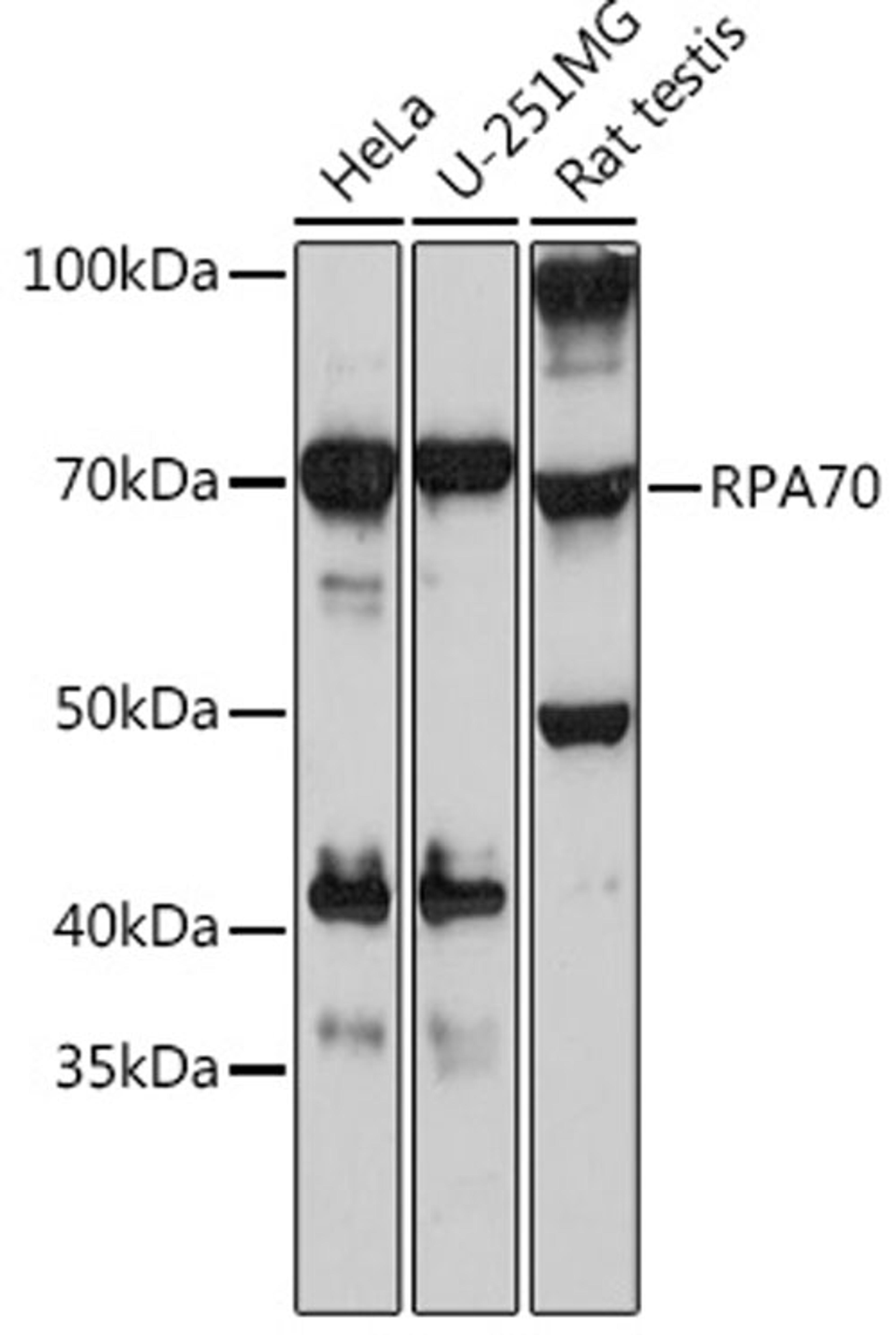 Western blot - RPA70 Rabbit mAb (A3367)