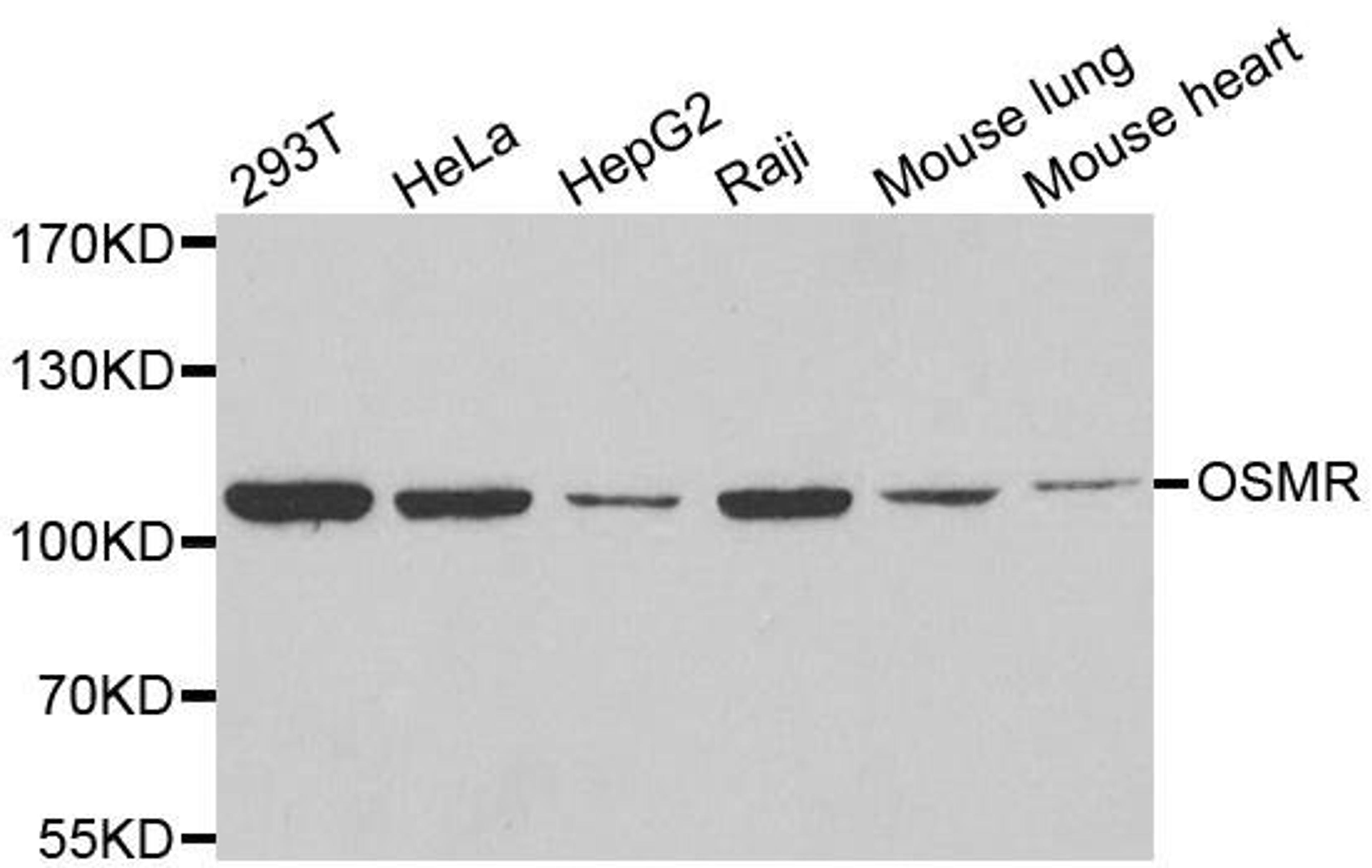 Western blot analysis of extracts of various cell lines using OSMR antibody