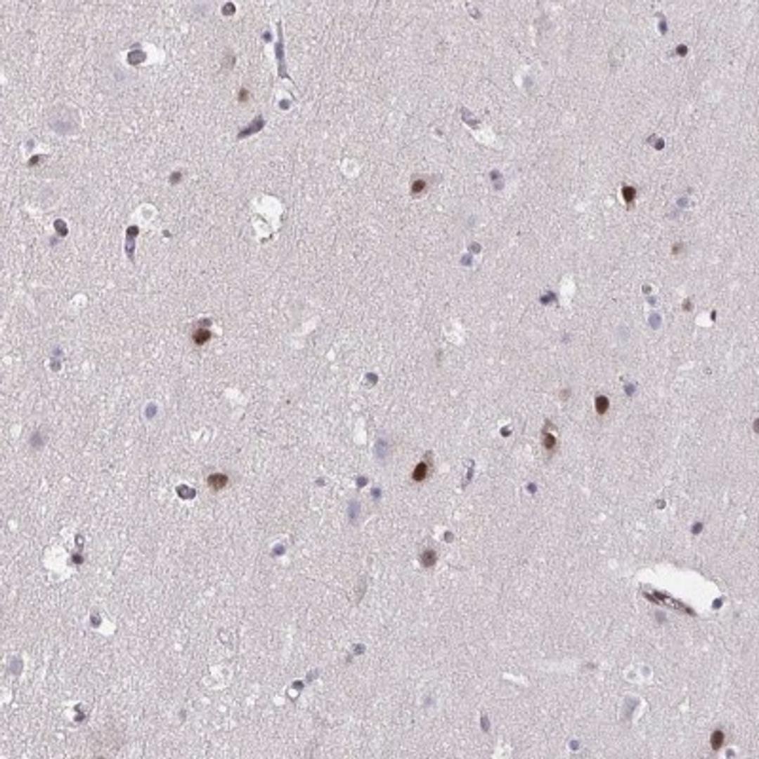 Immunohistochemistry: HOXA4 Antibody [NBP2-32515] - Staining of human cerebral cortex shows strong nuclear positivity in neuronal cells.