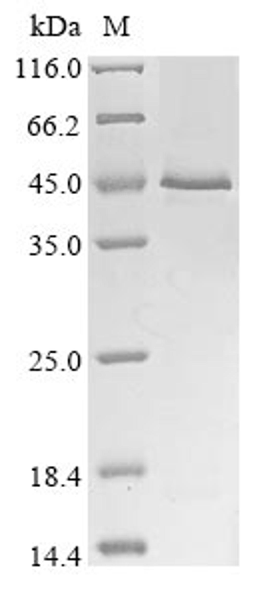 (Tris-Glycine gel) Discontinuous SDS-PAGE (reduced) with 5% enrichment gel and 15% separation gel.