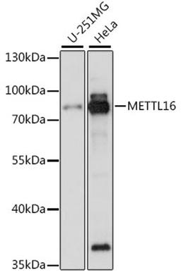 Western blot - METTL16 antibody (A15894)