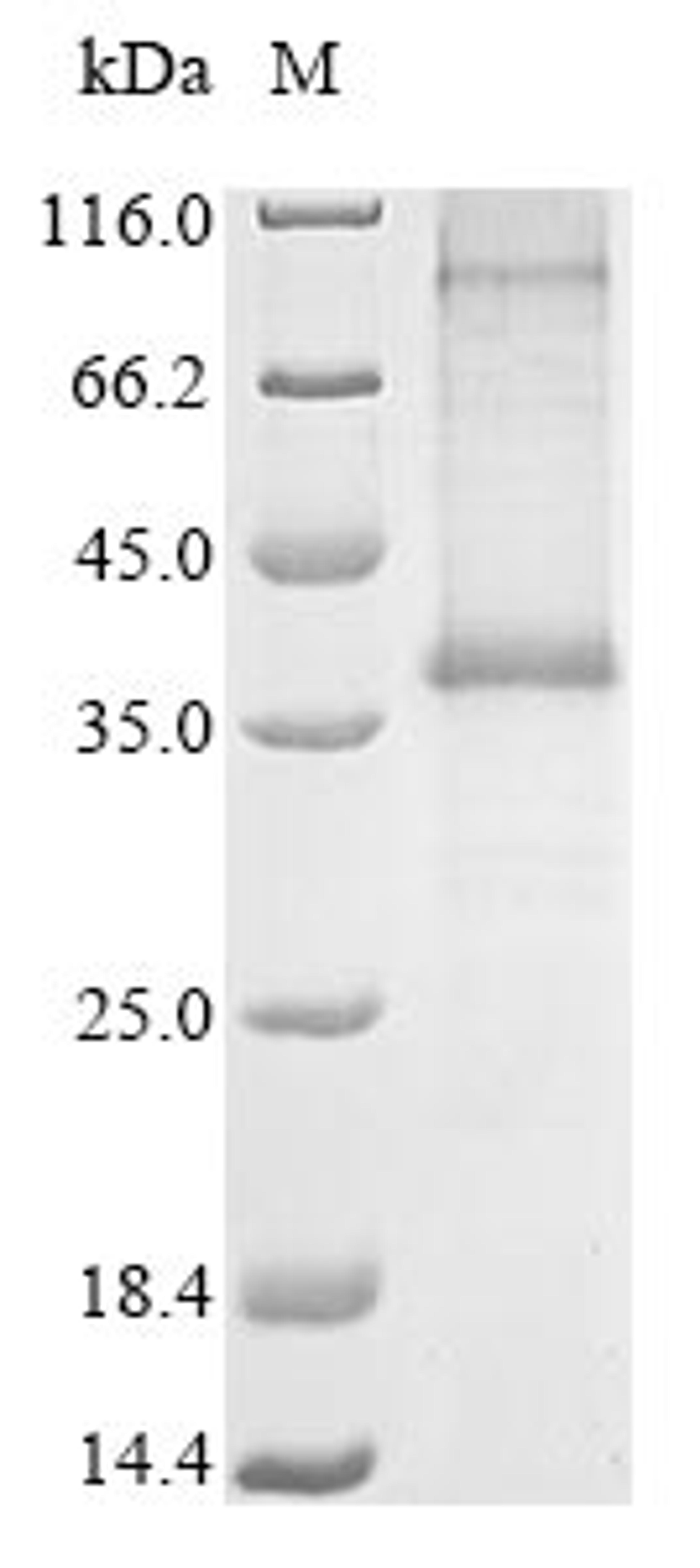 (Tris-Glycine gel) Discontinuous SDS-PAGE (reduced) with 5% enrichment gel and 15% separation gel.