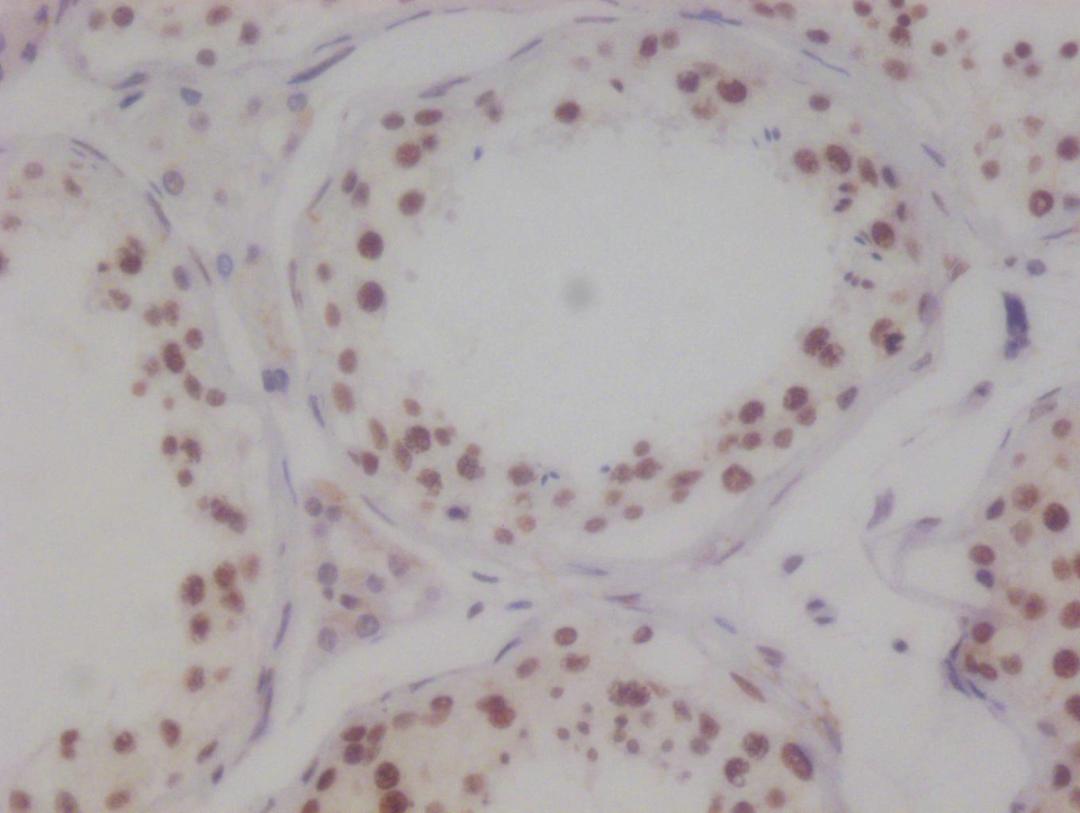 IHC image of CSB-RA694283A0HU diluted at 1:100 and staining in paraffin-embedded human testis tissue performed on a Leica BondTM system. After dewaxing and hydration, antigen retrieval was mediated by high pressure in a citrate buffer (pH 6.0). Section was blocked with 10% normal goat serum 30min at RT. Then primary antibody (1% BSA) was incubated at 4°C overnight. The primary is detected by a Goat anti-rabbit polymer IgG labeled by HRP and visualized using 0.05% DAB.