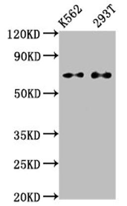 Western Blot. Positive WB detected in: K562 whole cell lysate, 293T whole cell lysate. All lanes: ATF2 antibody at 1.2μg/ml. Secondary. Goat polyclonal to rabbit IgG at 1/50000 dilution. Predicted band size: 55, 36, 24, 49, 53, 14, 25, 16 KDa. Observed band size: 70 KDa.