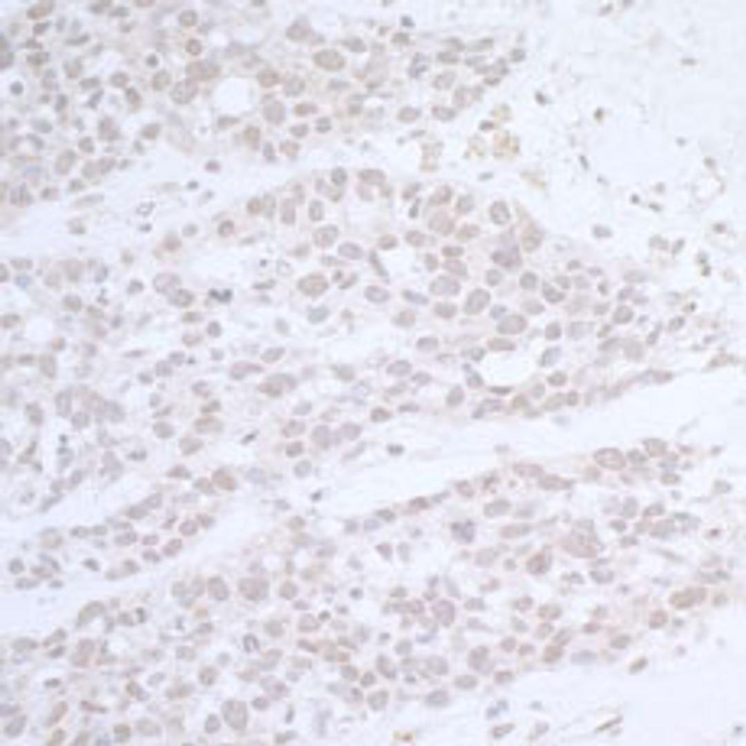 Detection of human CTR9 by immunohistochemistry.