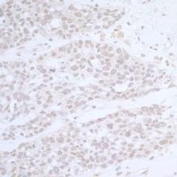 Detection of human CTR9 by immunohistochemistry.