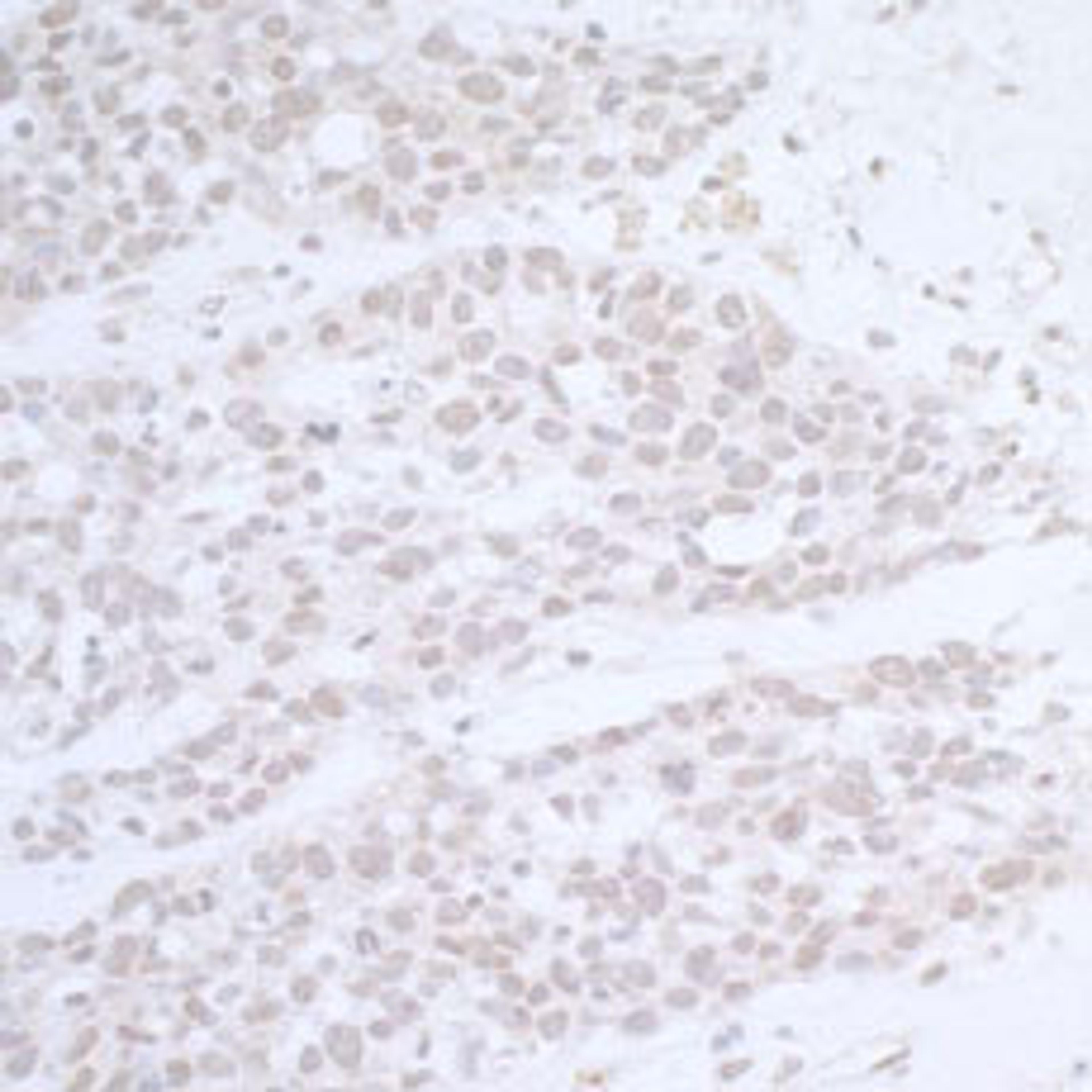 Detection of human CTR9 by immunohistochemistry.