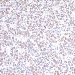 Detection of mouse PRMT1 by immunohistochemistry.