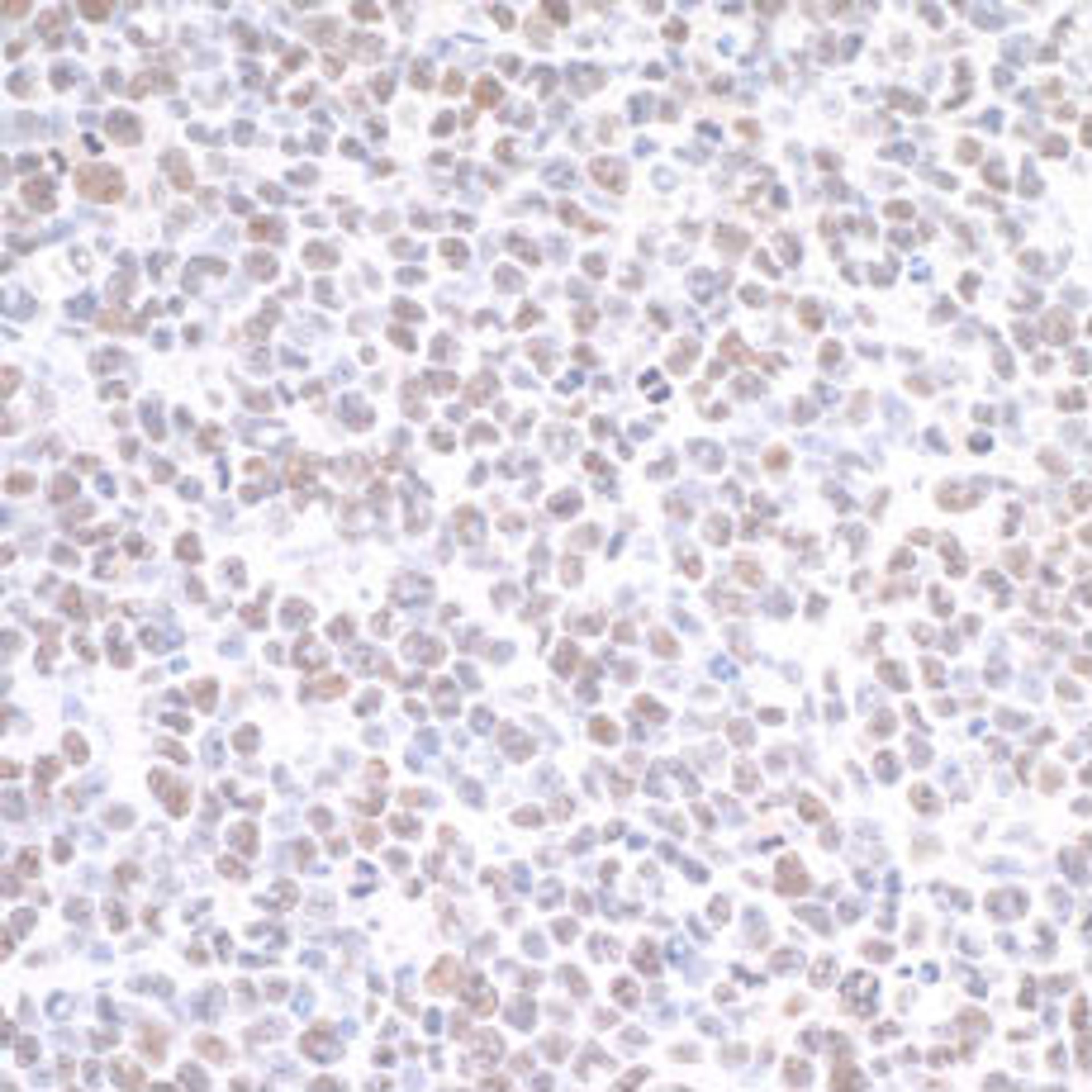 Detection of mouse PRMT1 by immunohistochemistry.