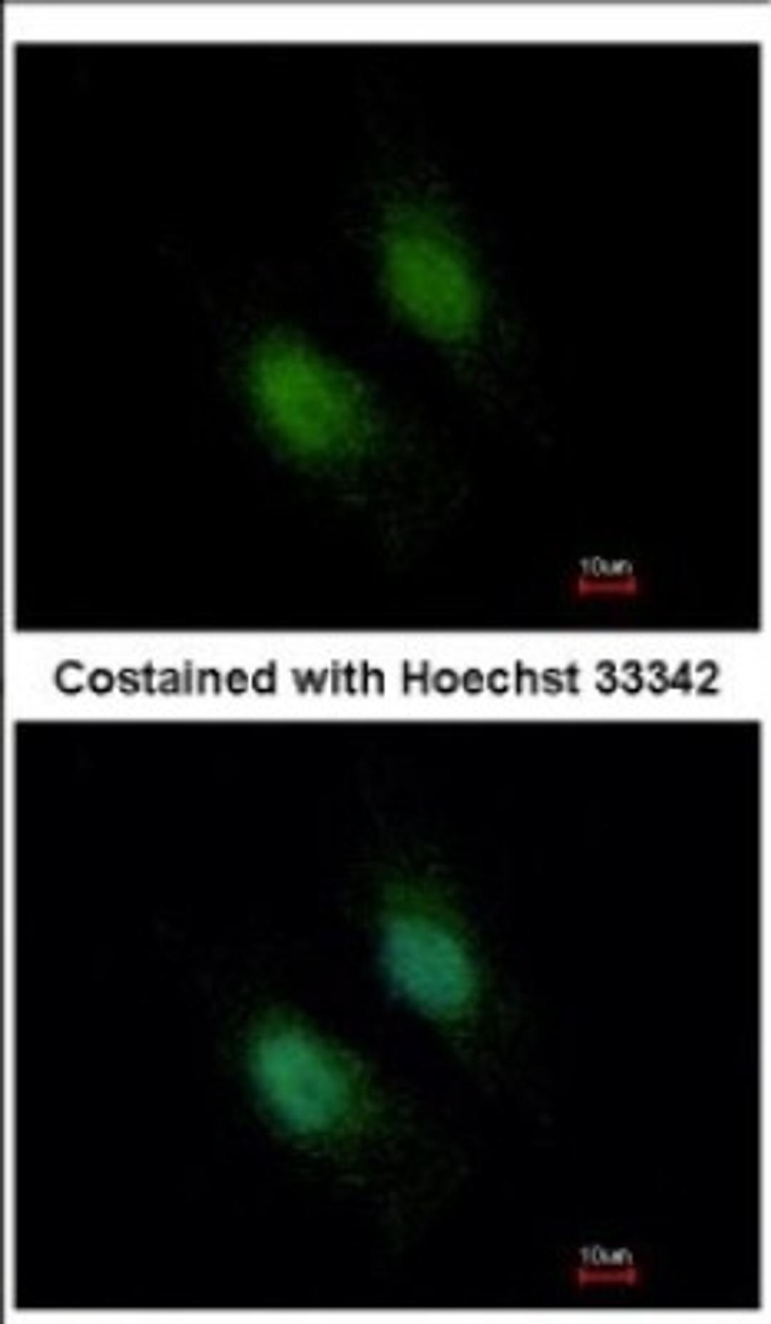 Immunocytochemistry/Immunofluorescence: STXBP2 Antibody [NBP2-20527] - Immunofluorescence analysis of paraformaldehyde-fixed HeLa, using antibody at 1:500 dilution.