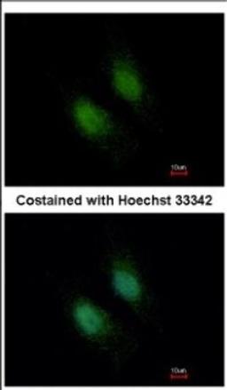 Immunocytochemistry/Immunofluorescence: STXBP2 Antibody [NBP2-20527] - Immunofluorescence analysis of paraformaldehyde-fixed HeLa, using antibody at 1:500 dilution.