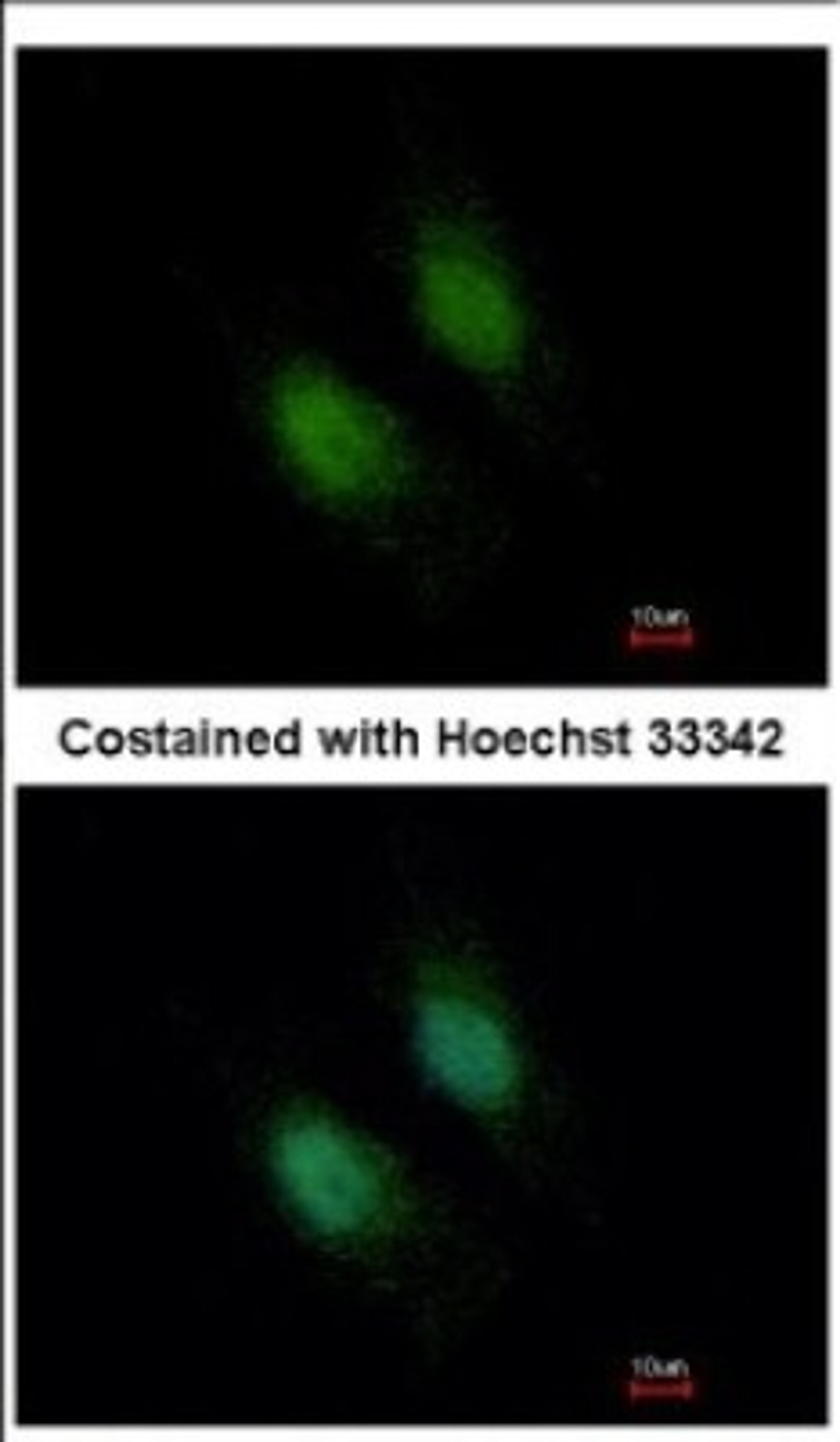 Immunocytochemistry/Immunofluorescence: STXBP2 Antibody [NBP2-20527] - Immunofluorescence analysis of paraformaldehyde-fixed HeLa, using antibody at 1:500 dilution.