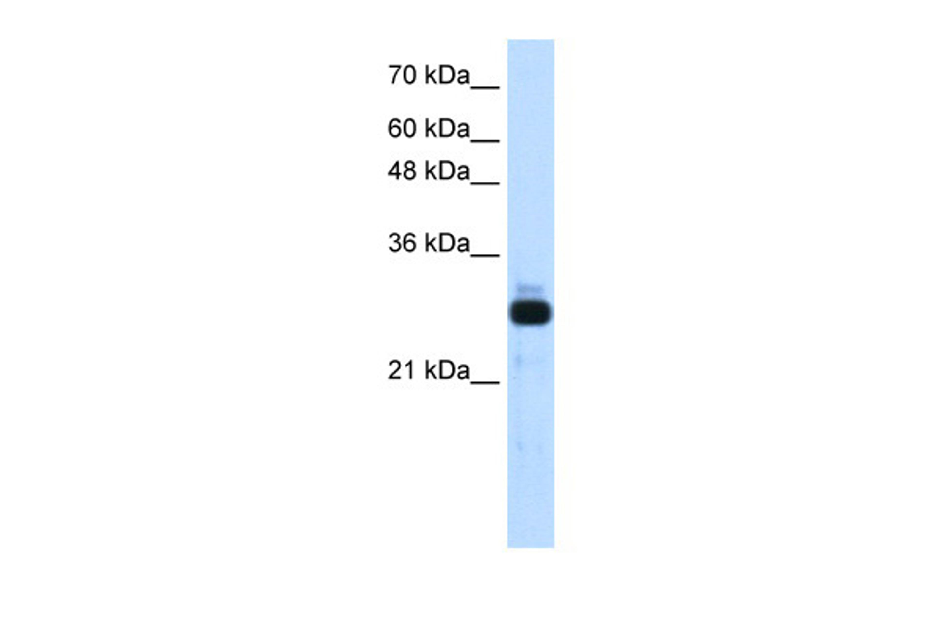 Antibody used in WB on Transfected 293T at 1.25 ug/ml.