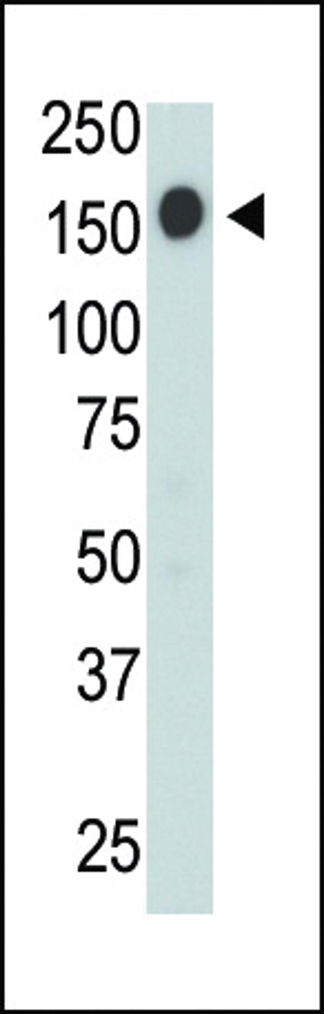 Antibody is used in Western blot to detect CD45 in jurkat cell lysate.