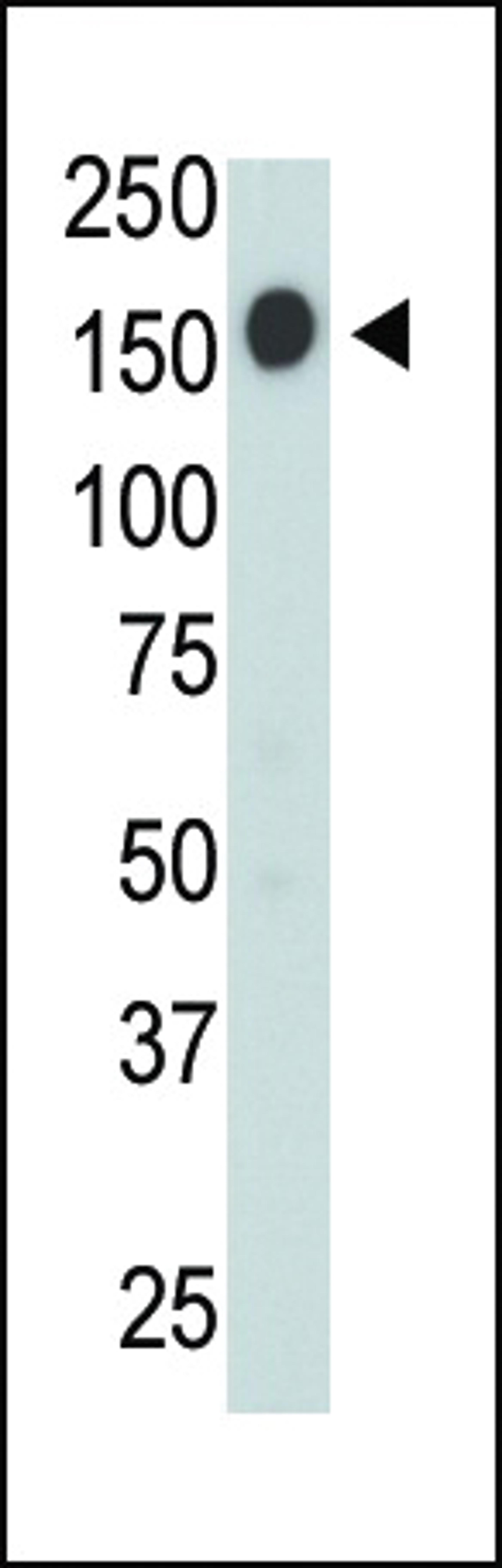 Antibody is used in Western blot to detect CD45 in jurkat cell lysate.