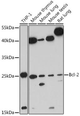 Western blot - Bcl-2 antibody (A11313)